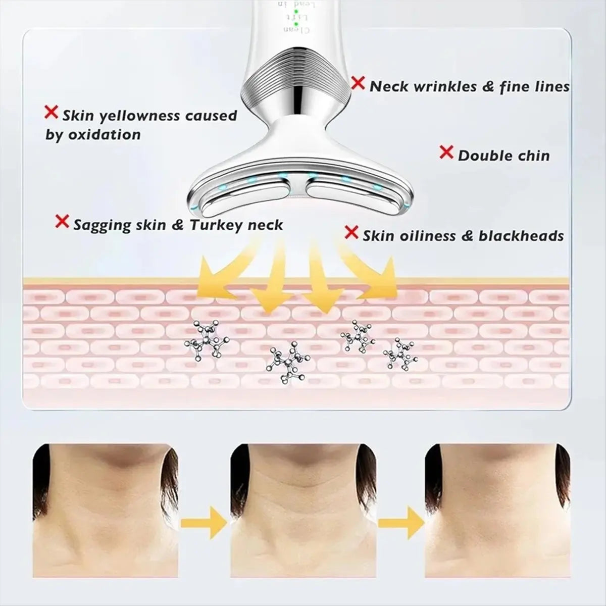 N18R Cervical Massager Neck Beauty Device Multi-Function Neck Massager Neck and Nasolabial Fold Removal Device