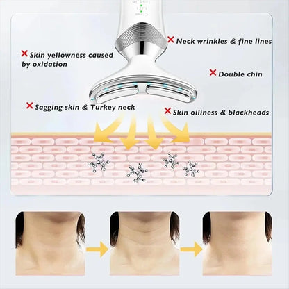 N18R Cervical Massager Neck Beauty Device Multi-Function Neck Massager Neck and Nasolabial Fold Removal Device